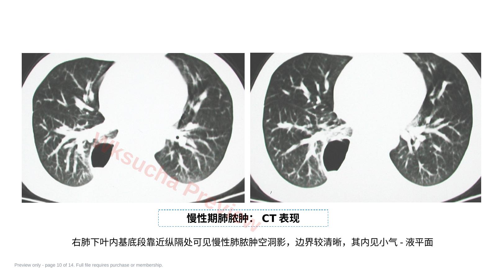 预览第 10 页