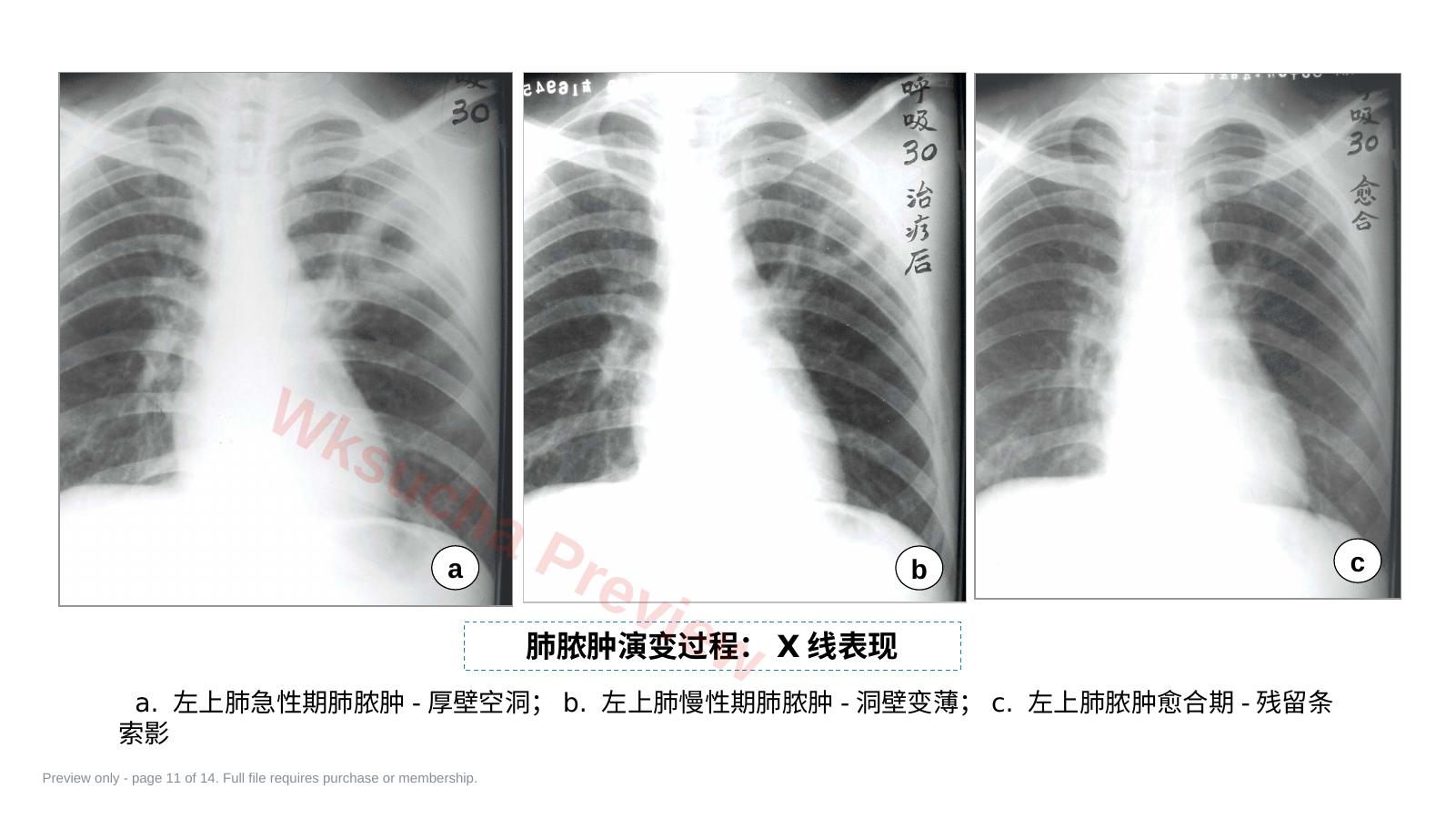 预览第 11 页