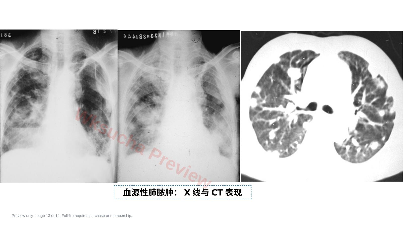预览第 13 页