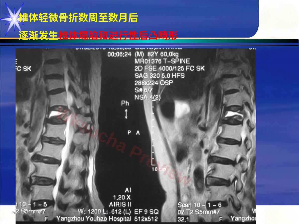 预览第 15 页
