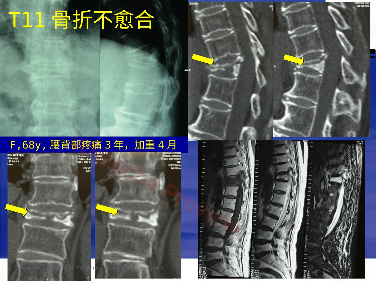 预览第 37 页