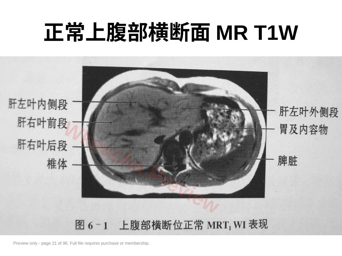 预览第 21 页
