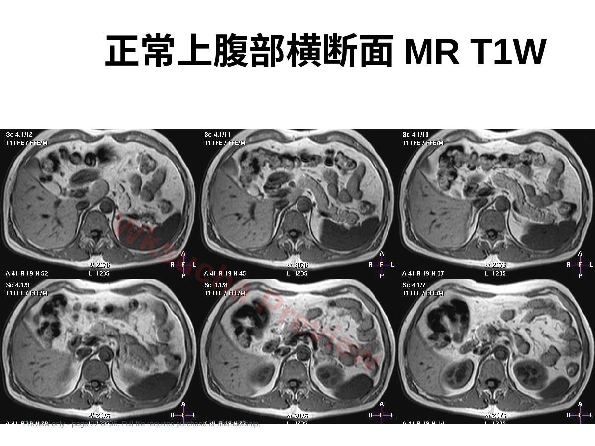 预览第 22 页