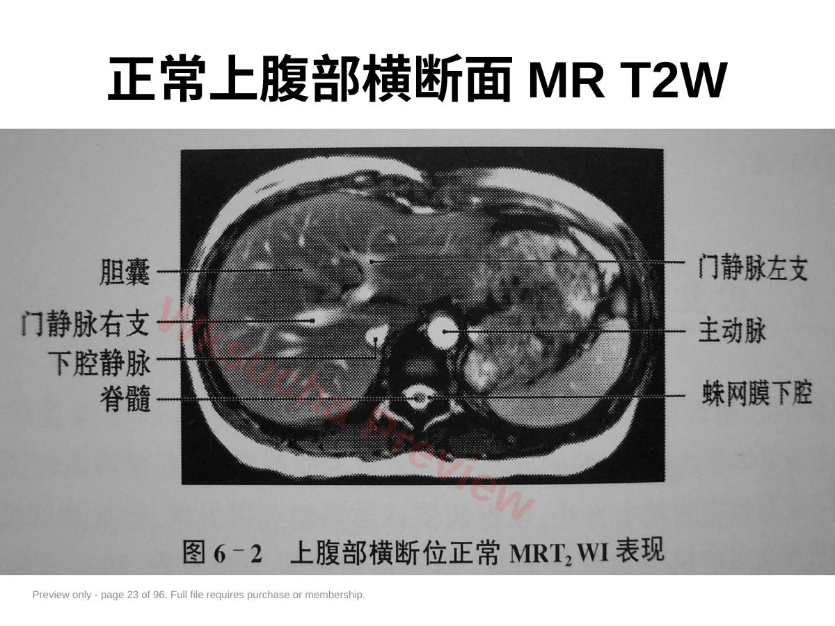 预览第 23 页
