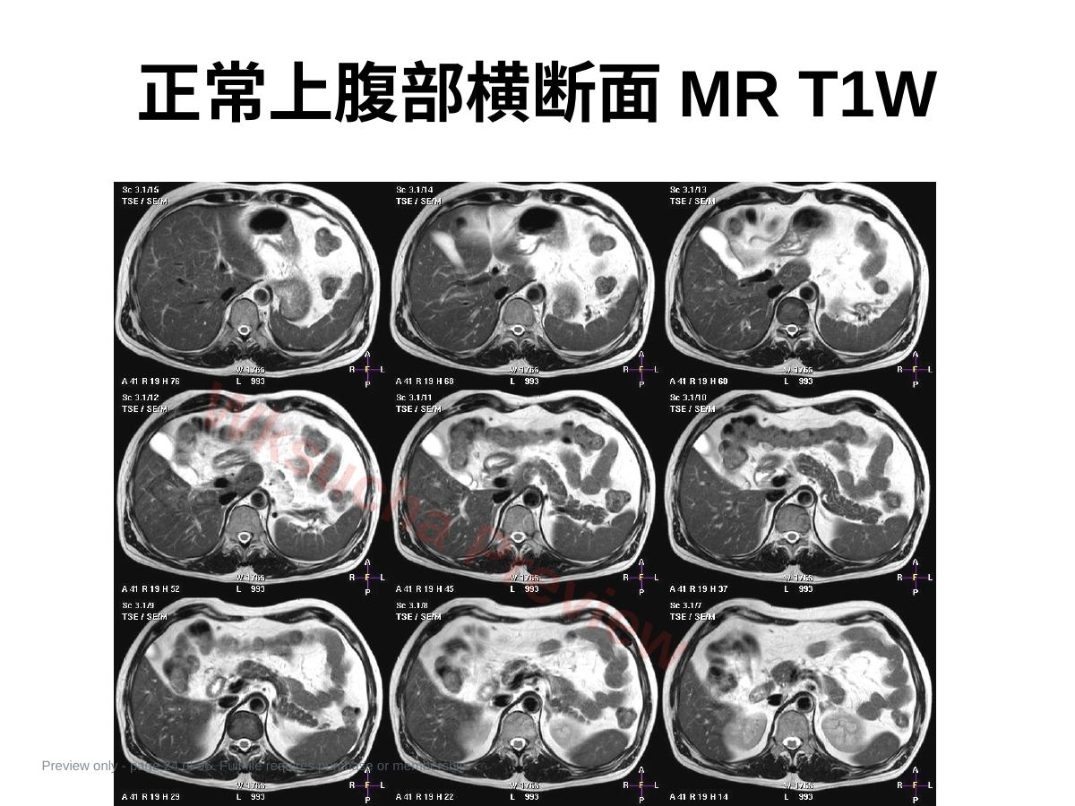 预览第 24 页