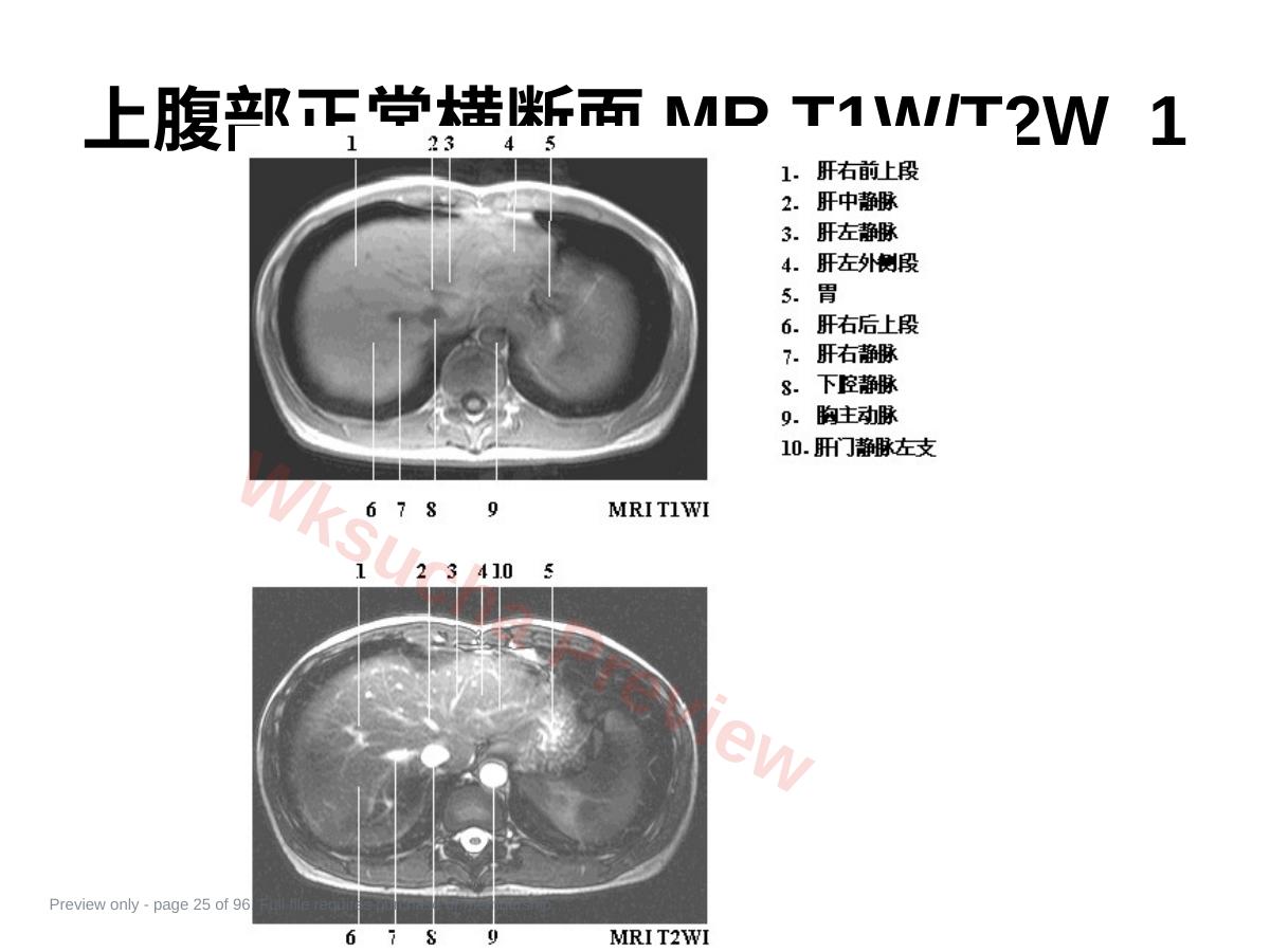 预览第 25 页