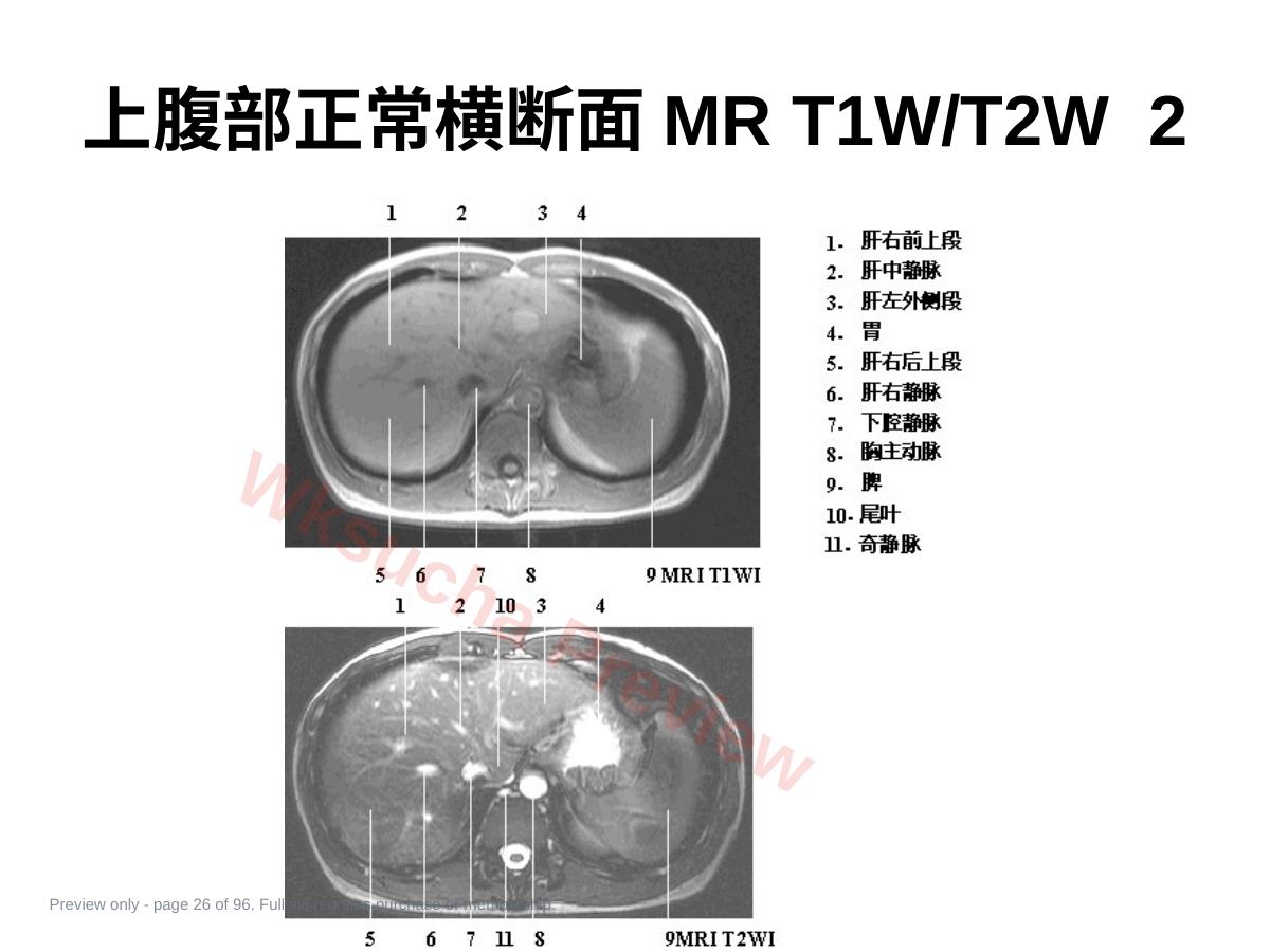 预览第 26 页