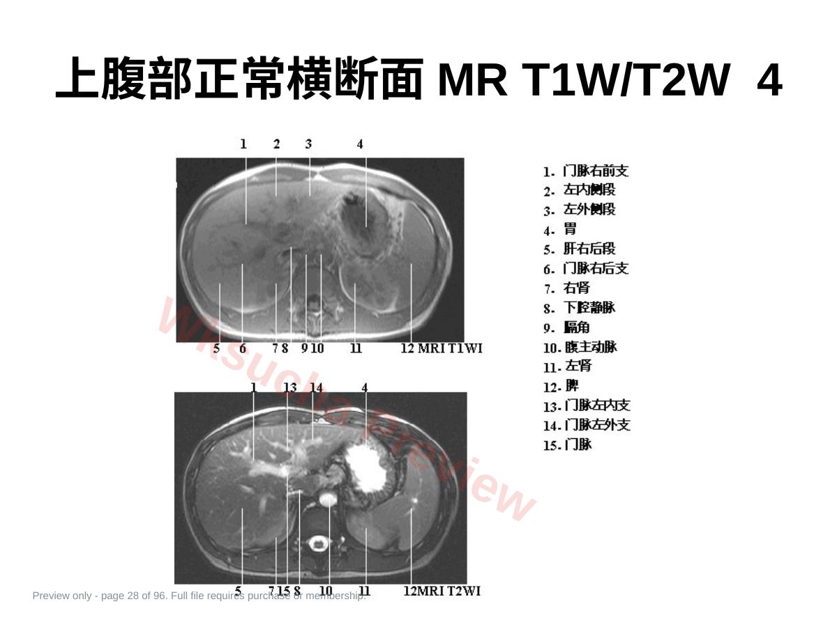 预览第 28 页