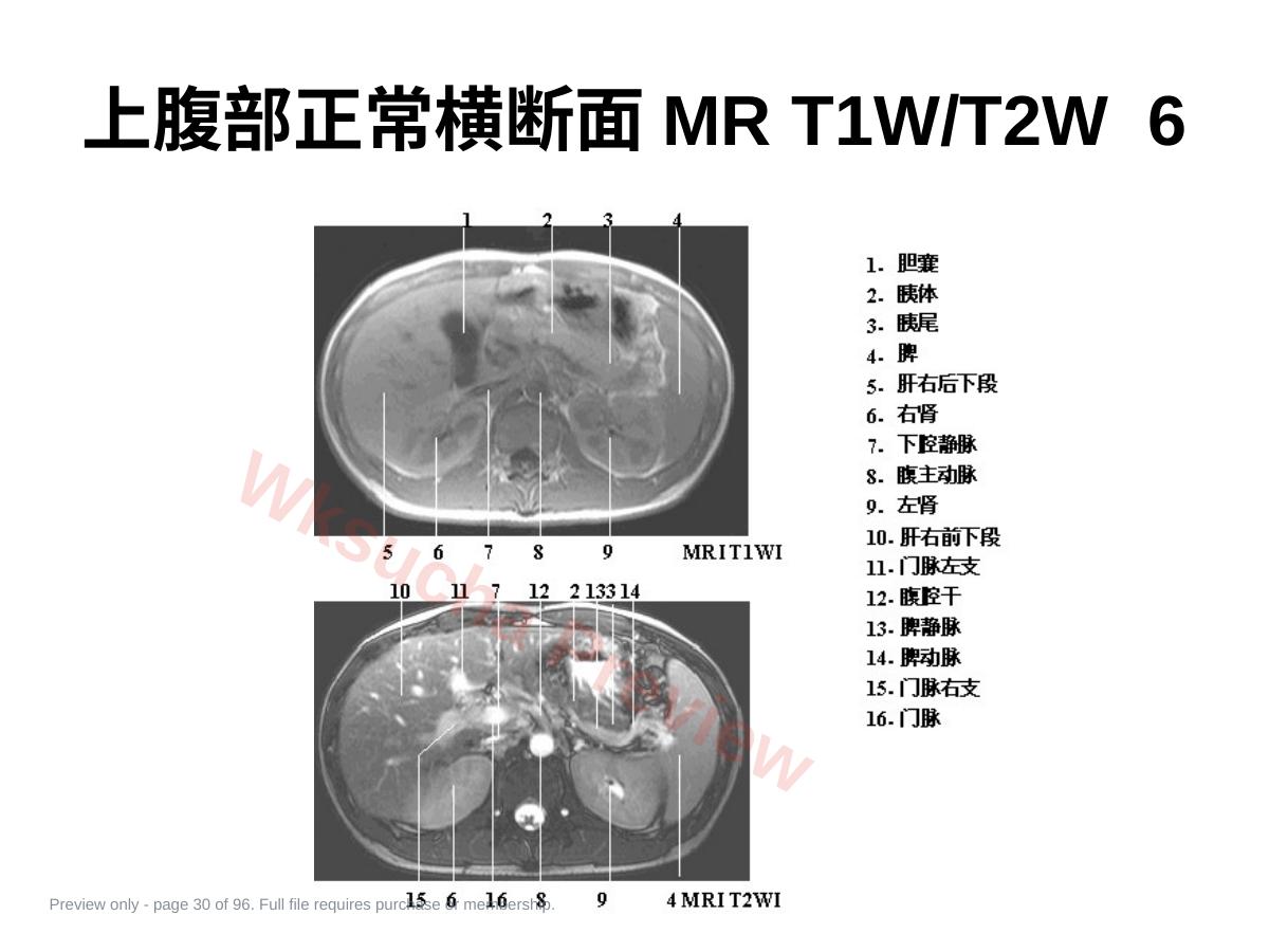 预览第 30 页