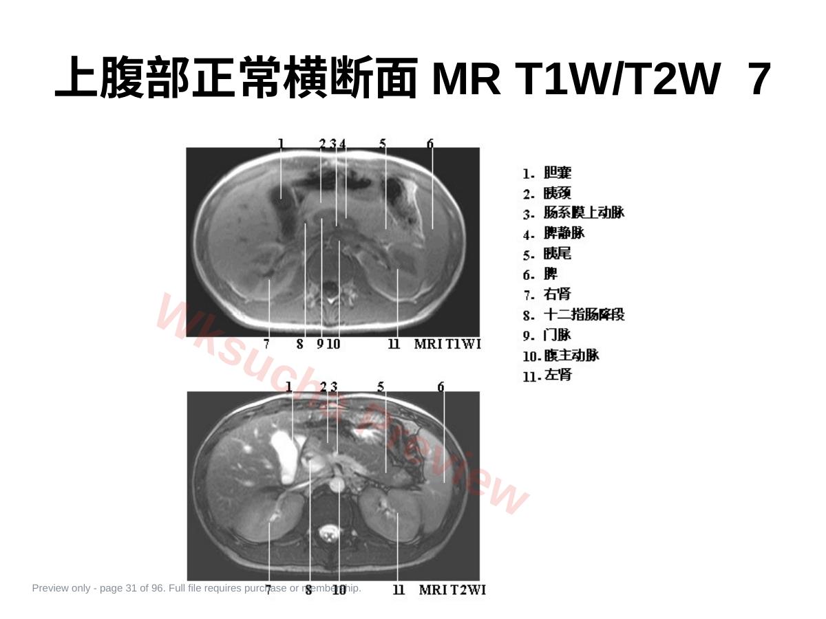 预览第 31 页