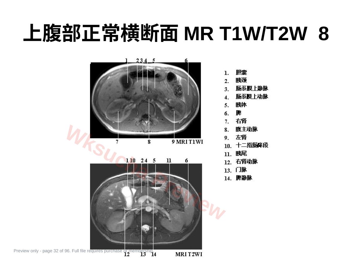 预览第 32 页