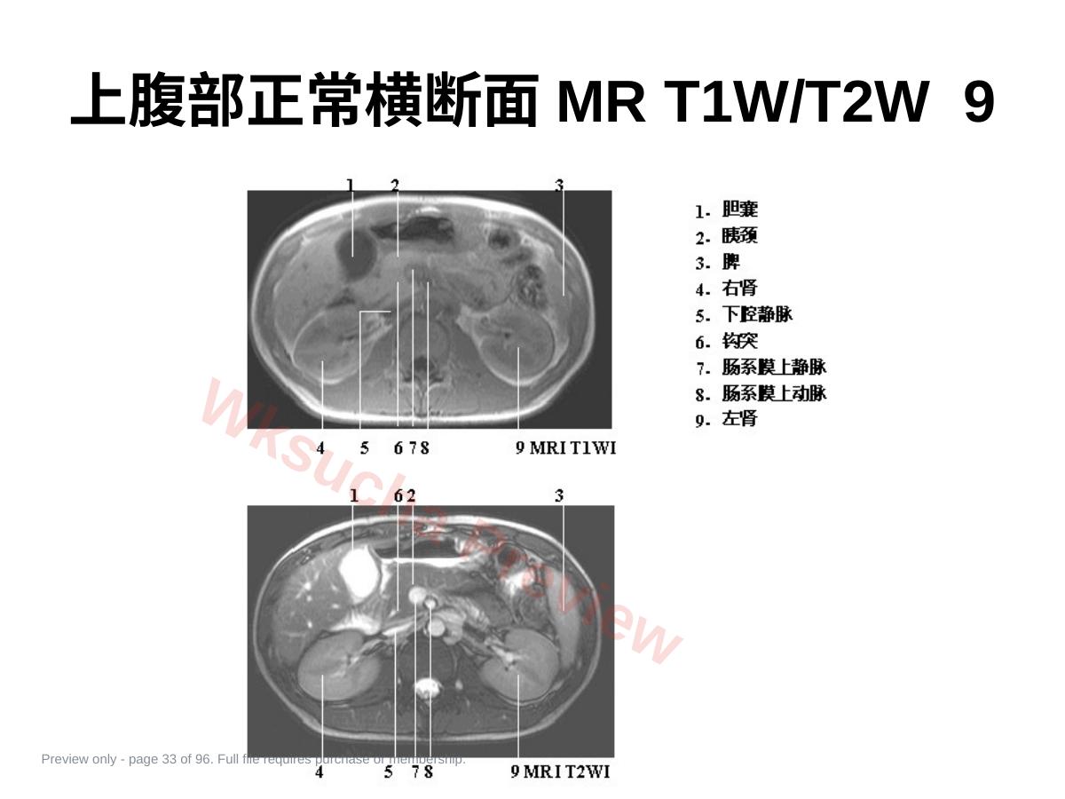 预览第 33 页
