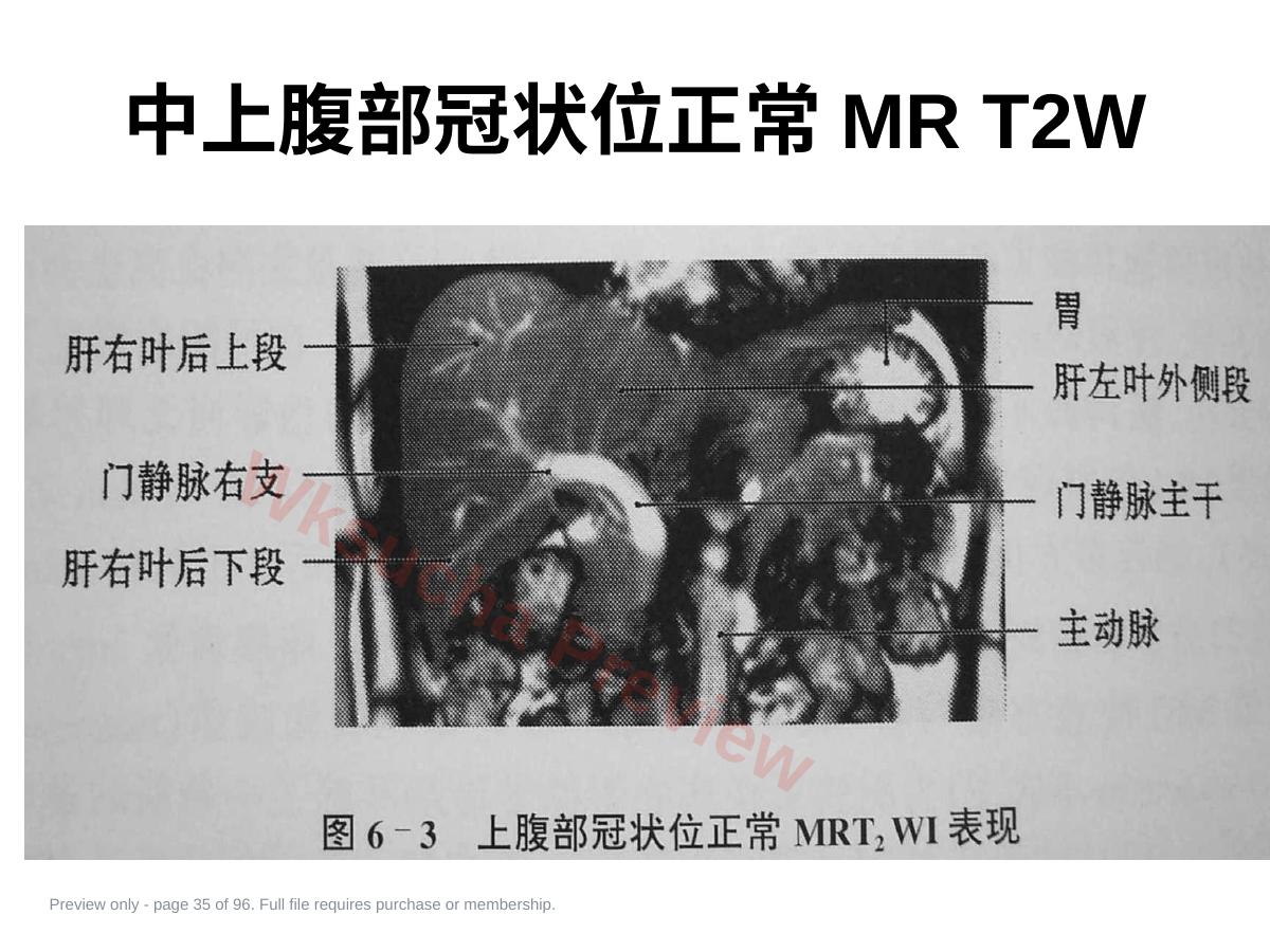 预览第 35 页