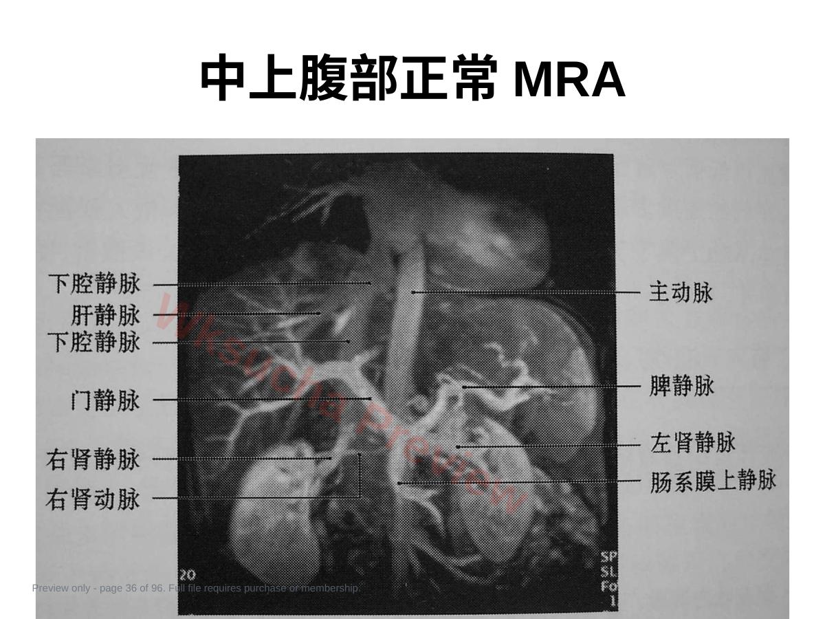 预览第 36 页