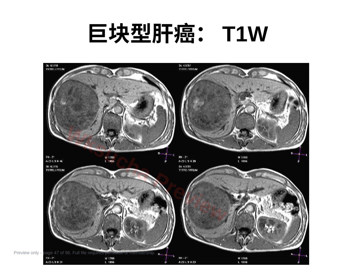 预览第 47 页