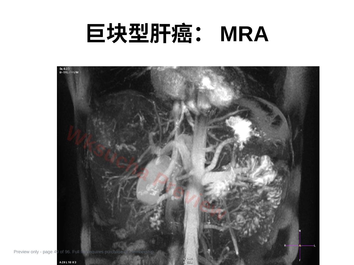预览第 49 页