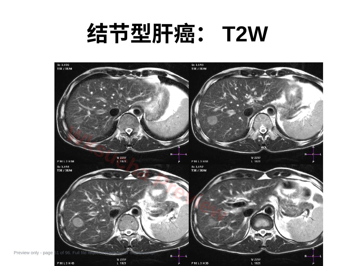 预览第 51 页