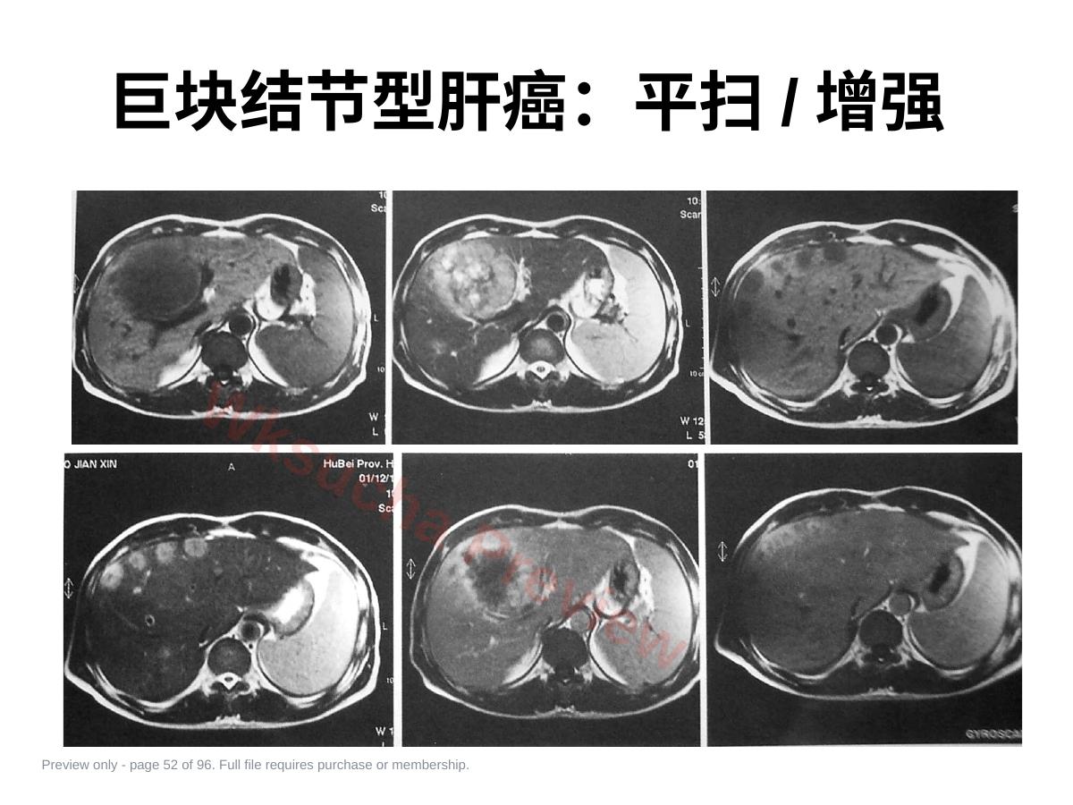 预览第 52 页