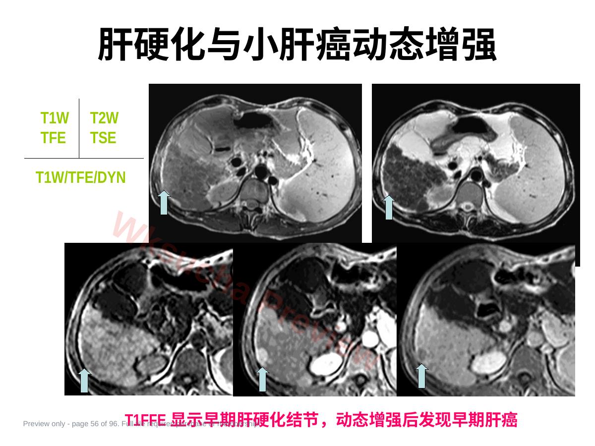预览第 56 页