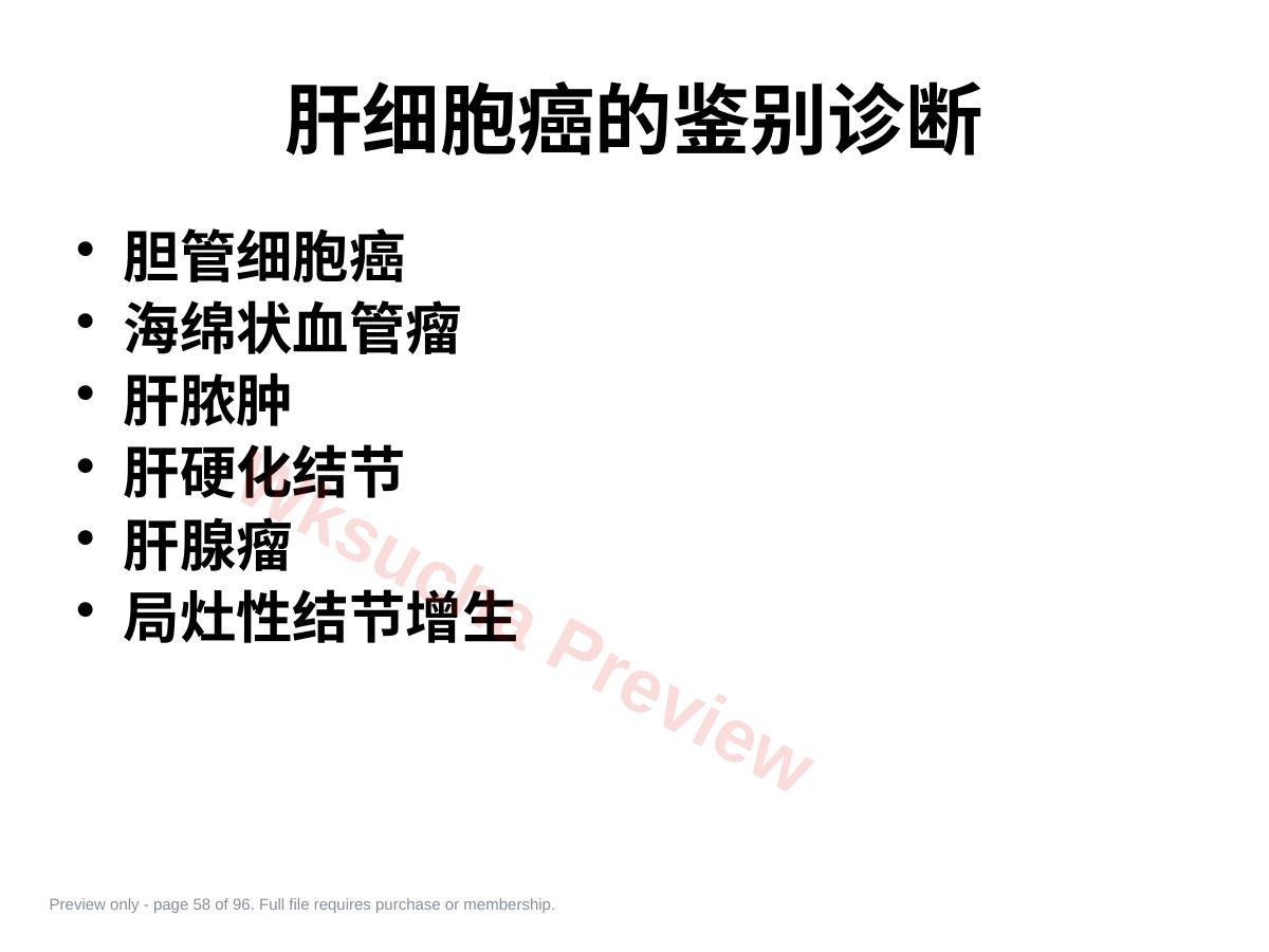 预览第 58 页