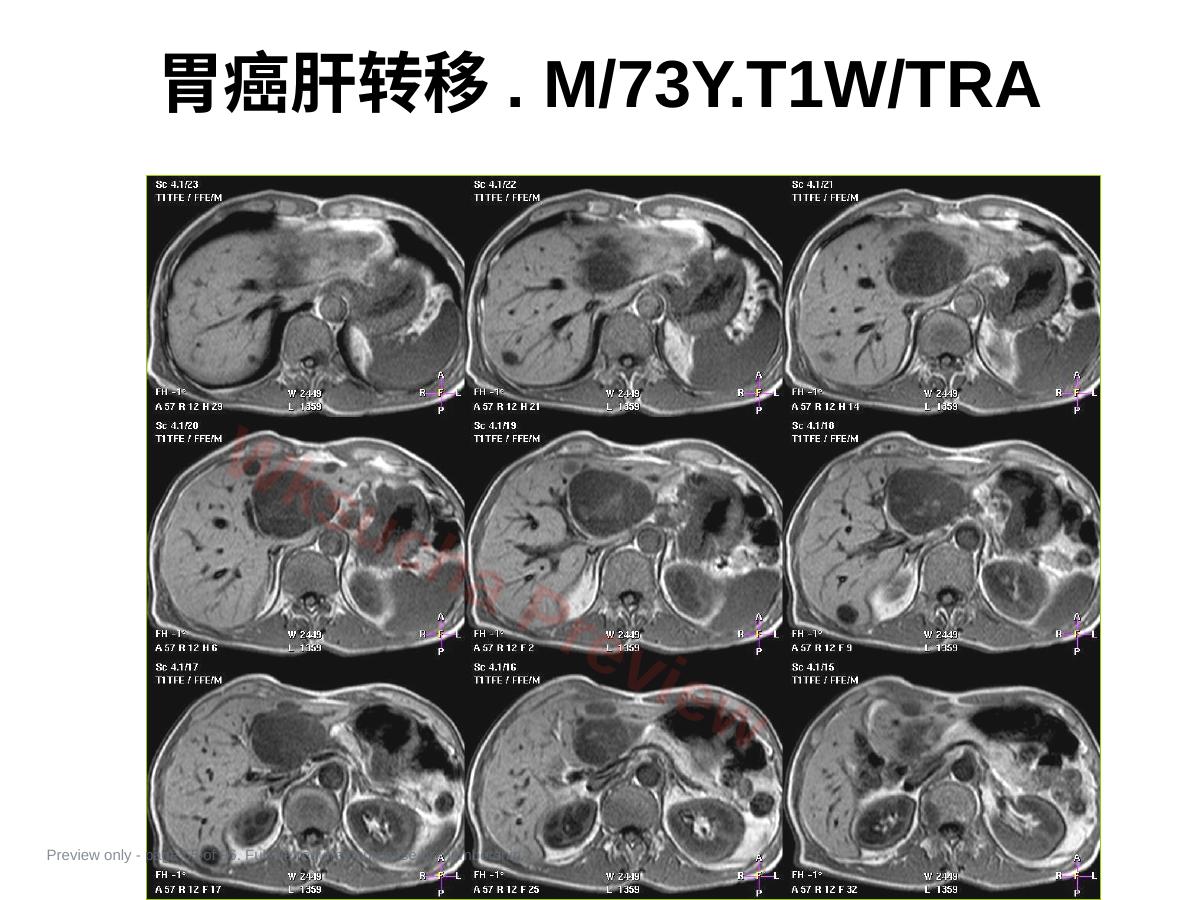 预览第 65 页