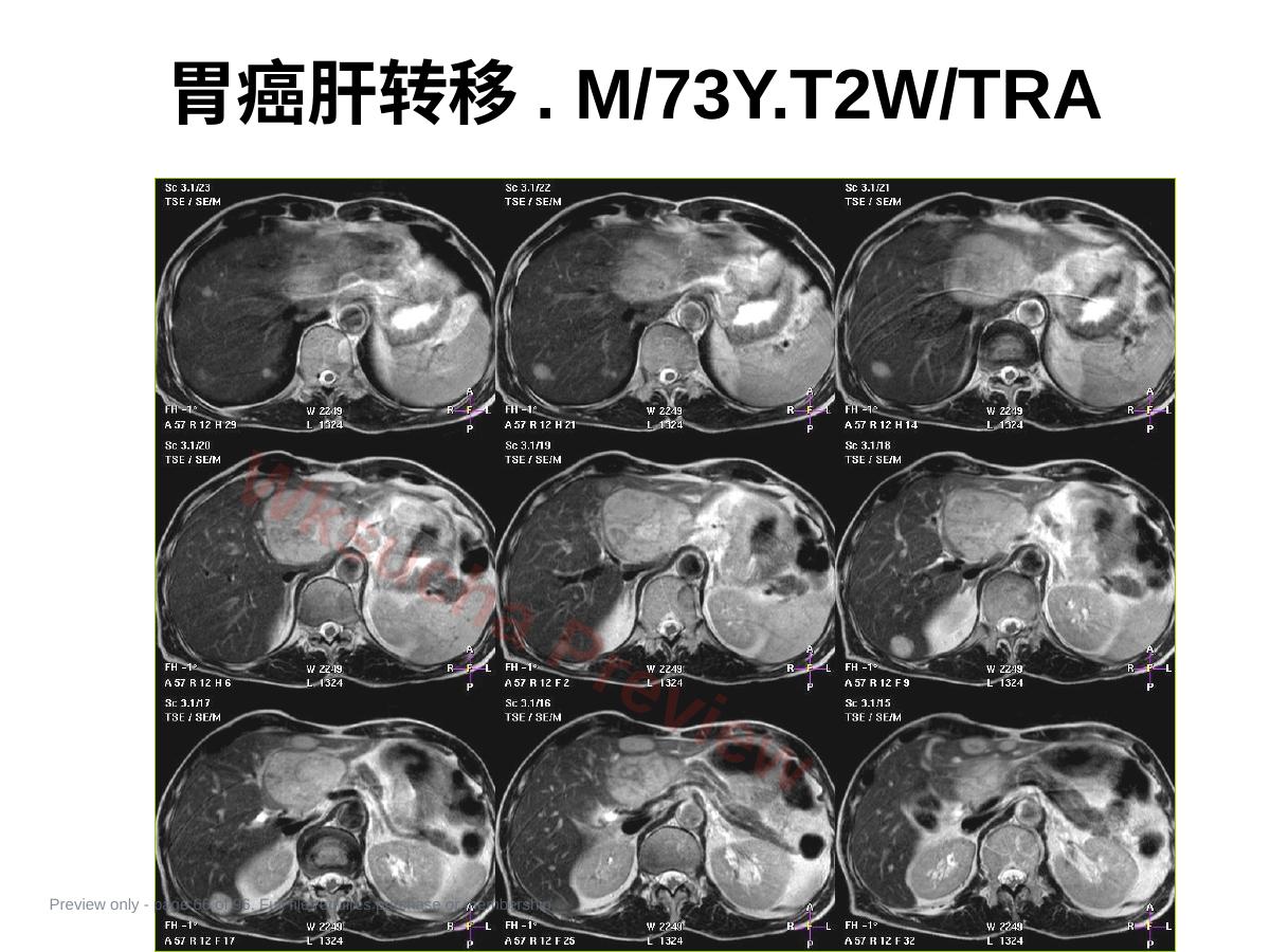 预览第 66 页