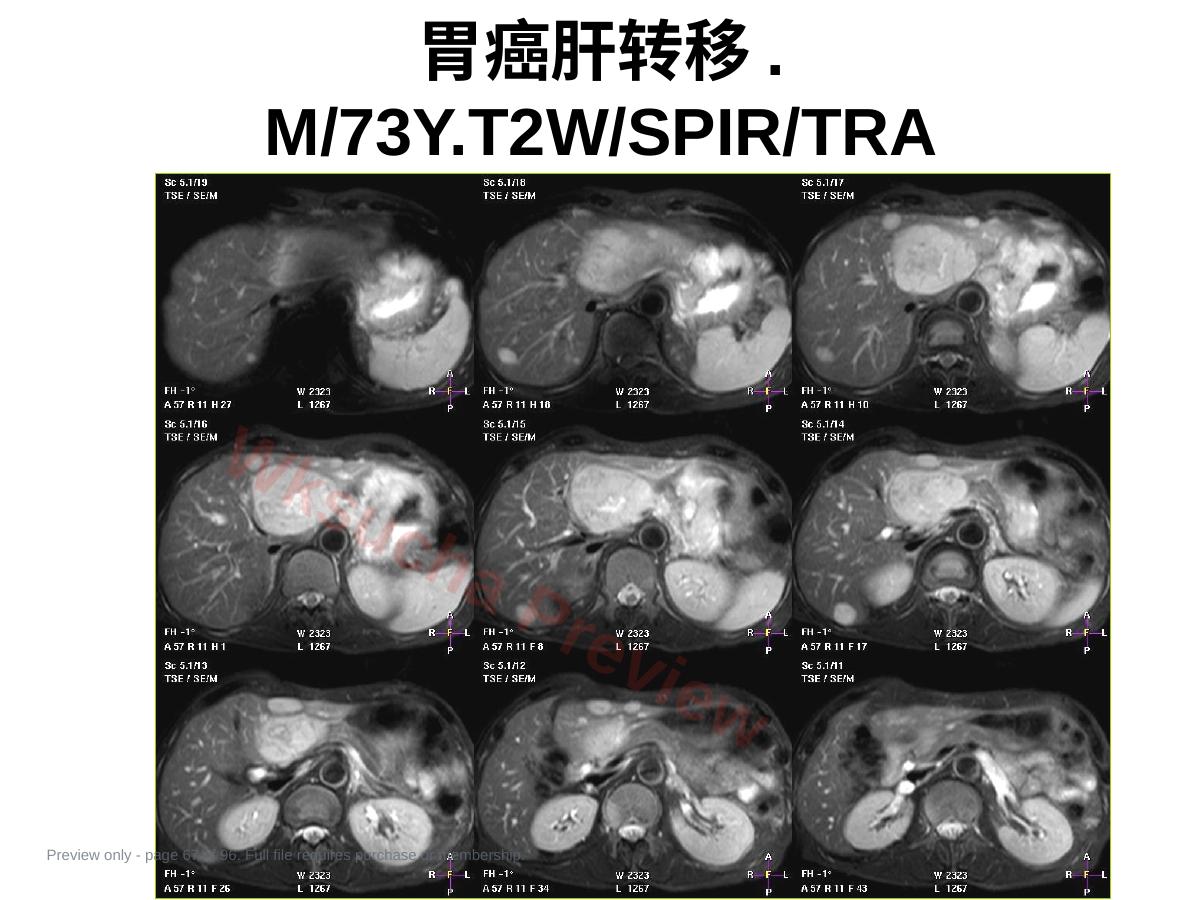 预览第 67 页
