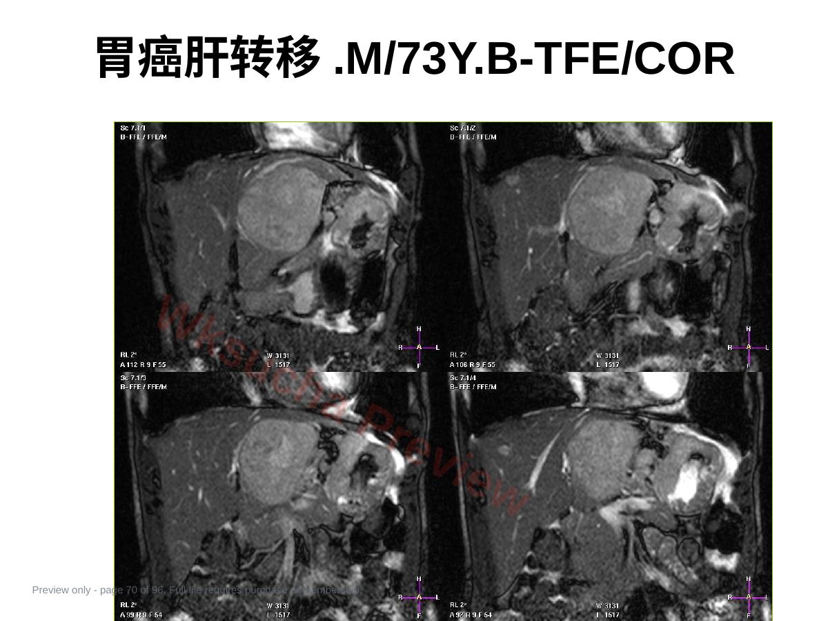 预览第 70 页