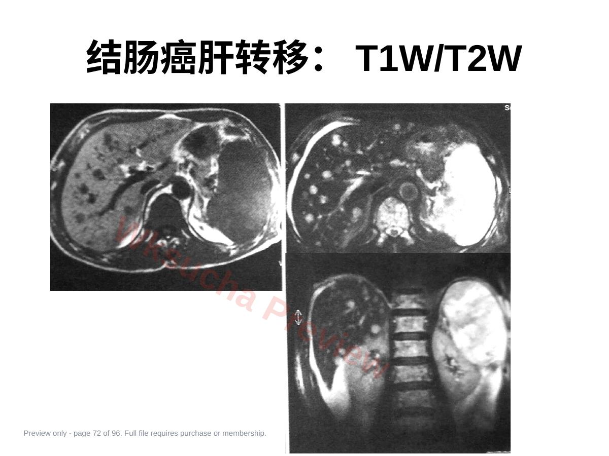预览第 72 页
