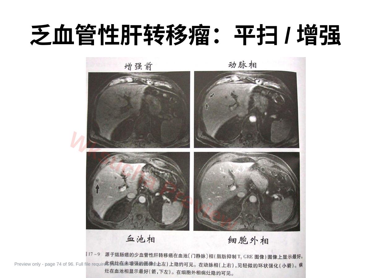 预览第 74 页
