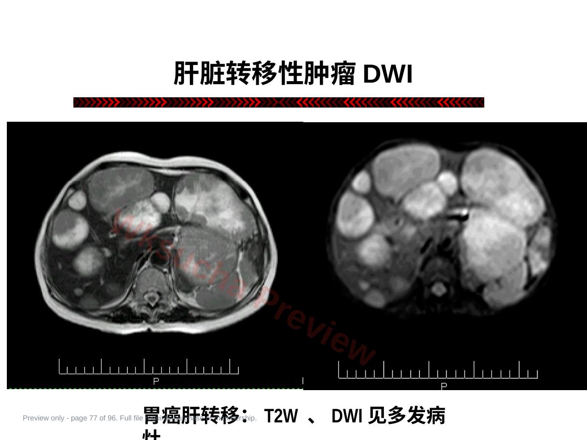 预览第 77 页