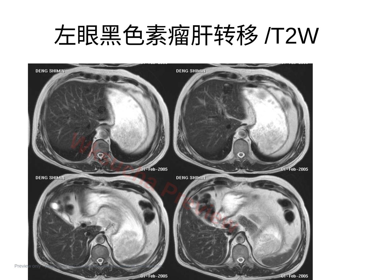 预览第 79 页