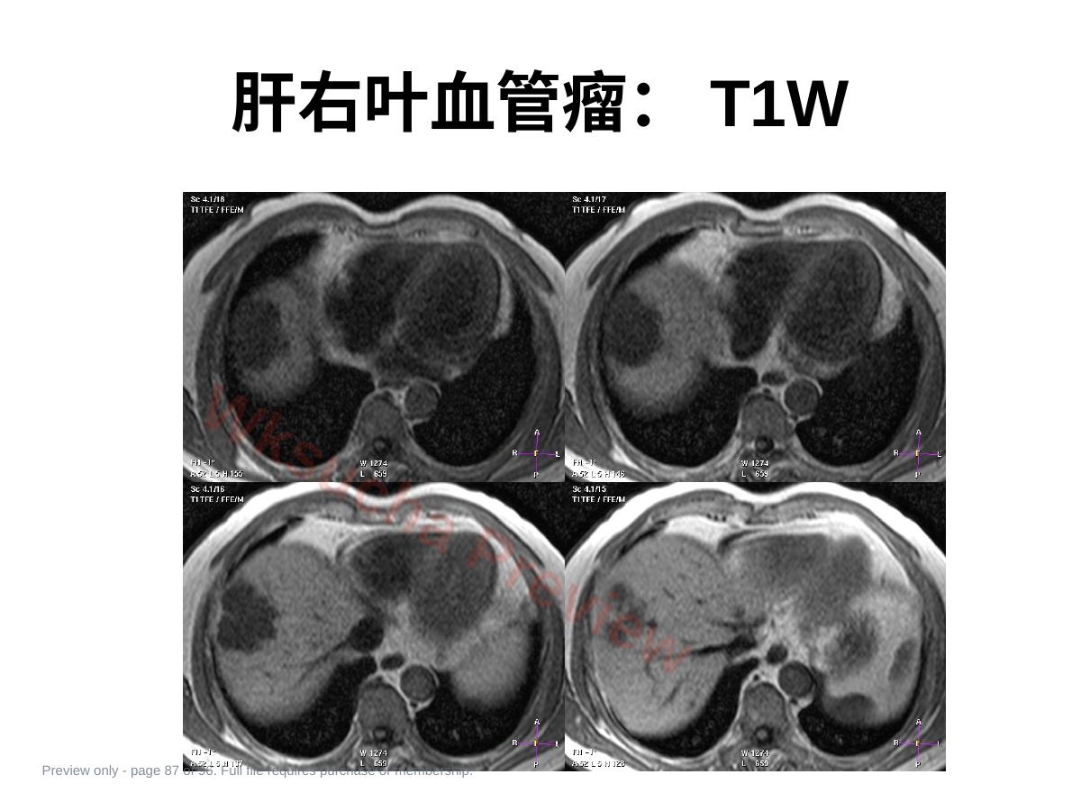 预览第 87 页