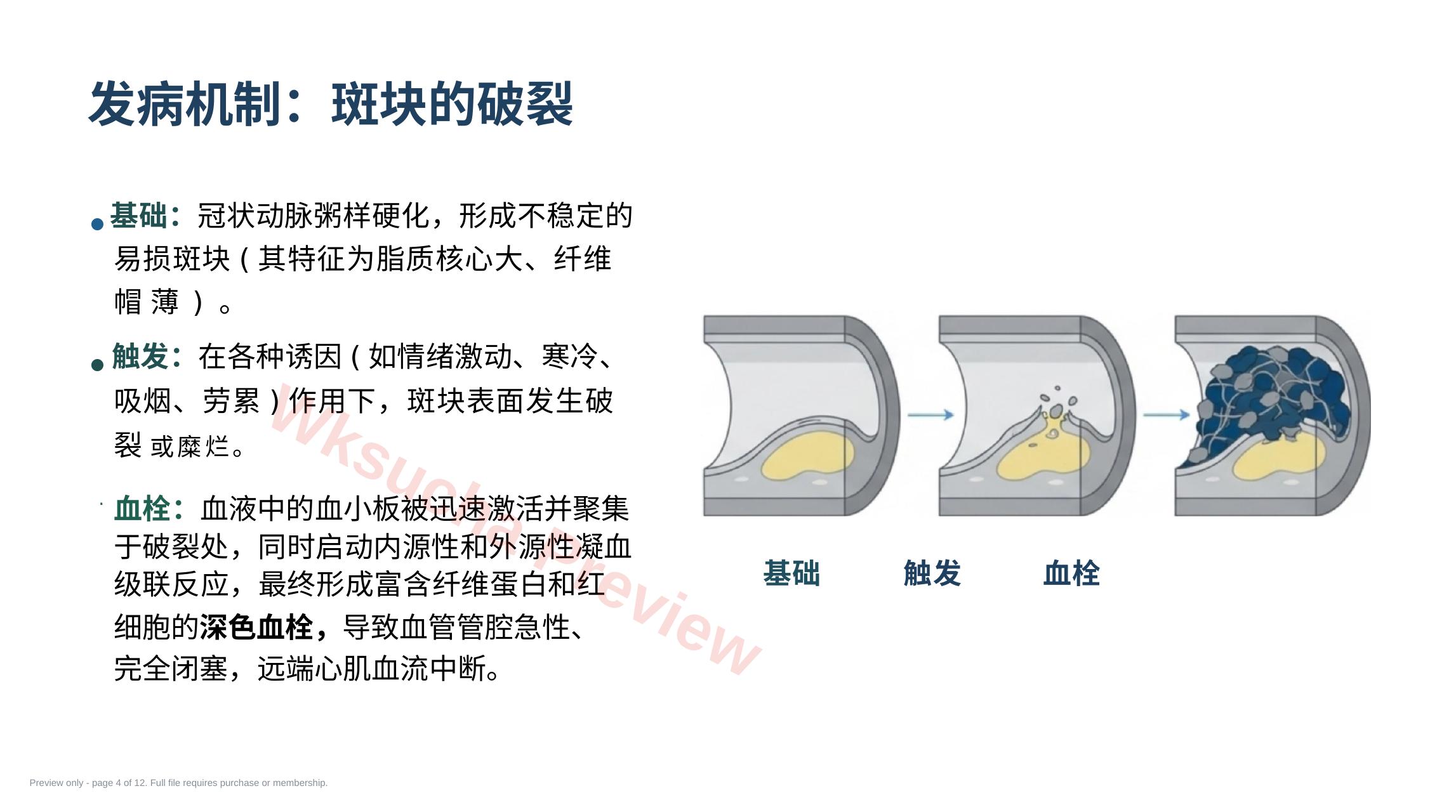 预览第 4 页