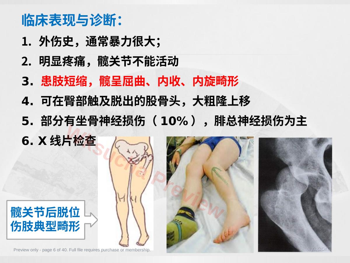 预览第 6 页