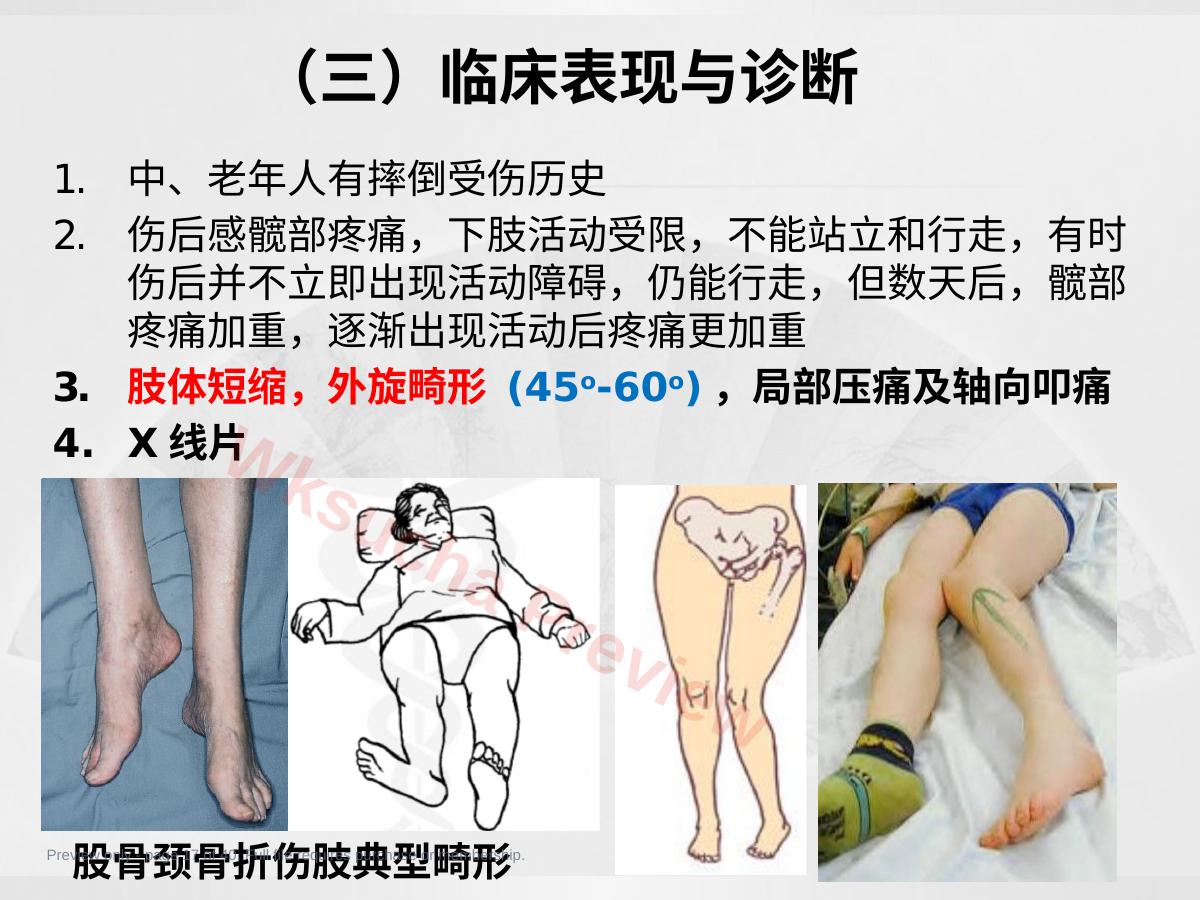 预览第 17 页