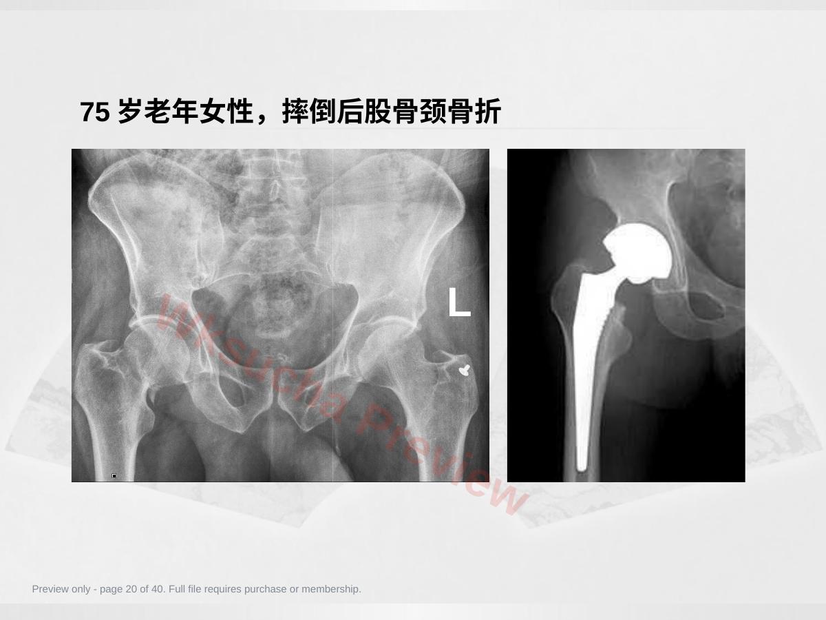 预览第 20 页