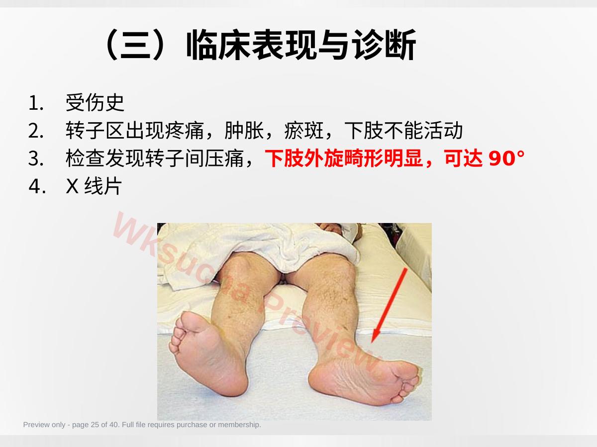 预览第 25 页
