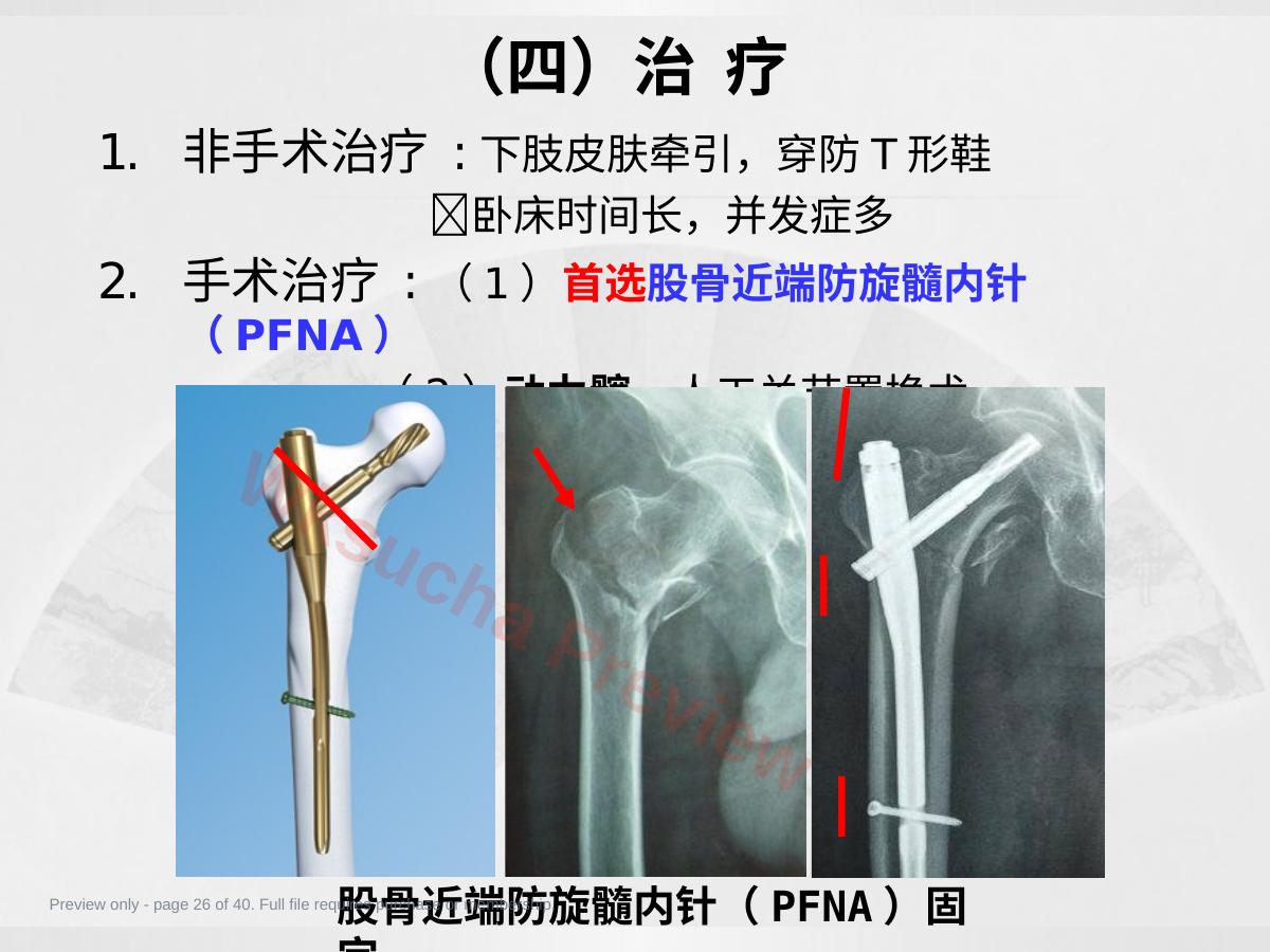 预览第 26 页
