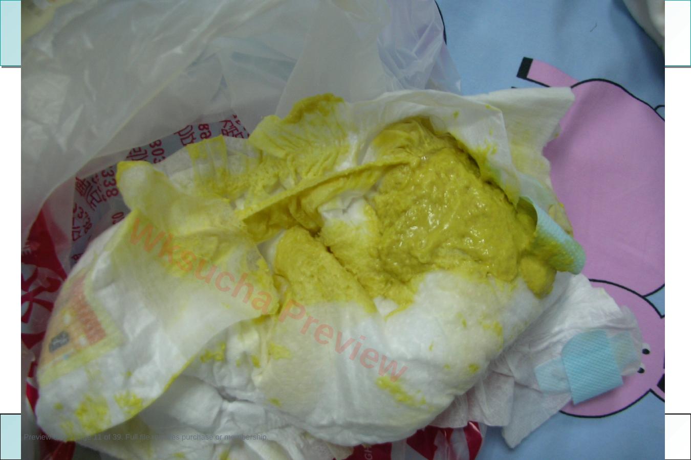 预览第 11 页