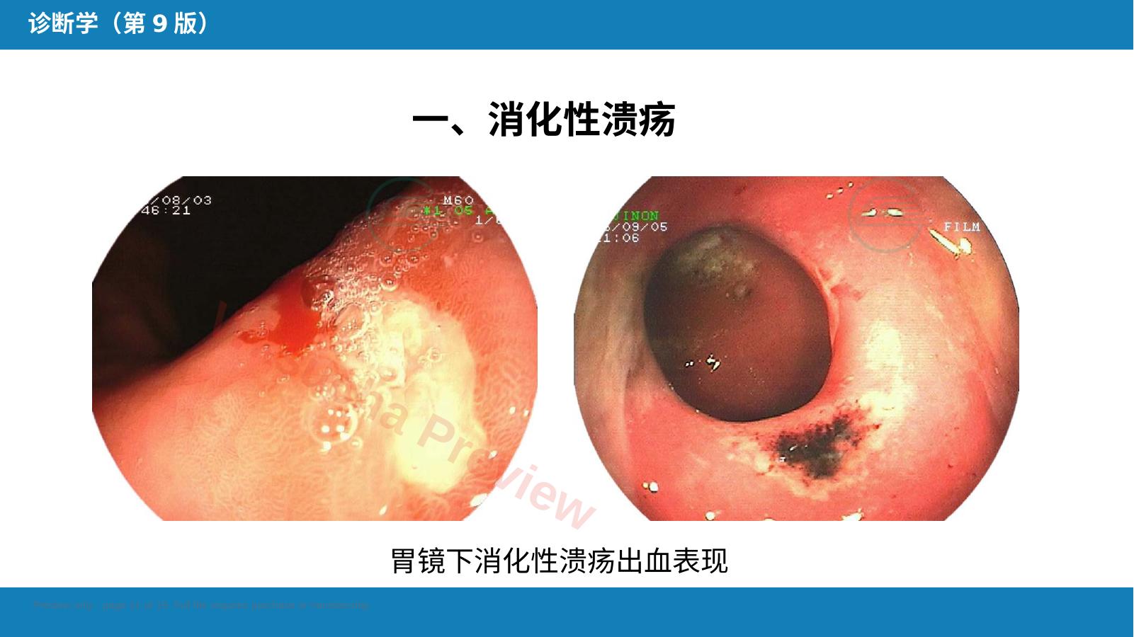 预览第 11 页