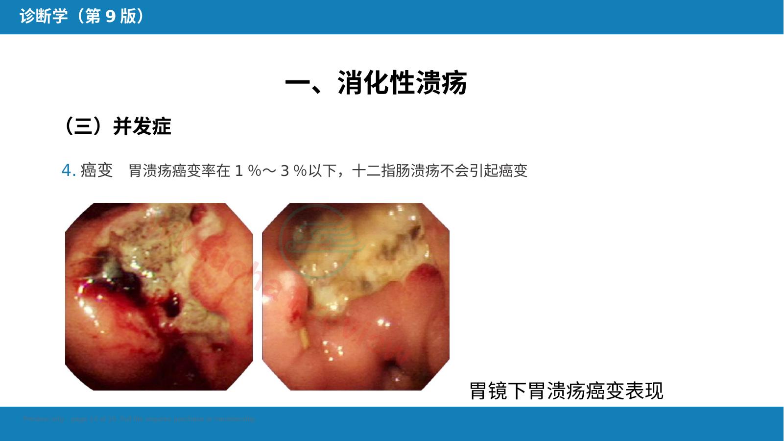 预览第 14 页
