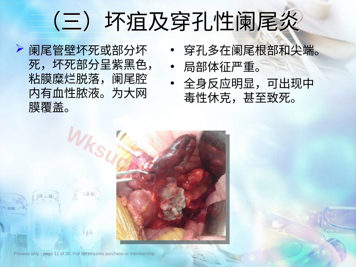 预览第 11 页