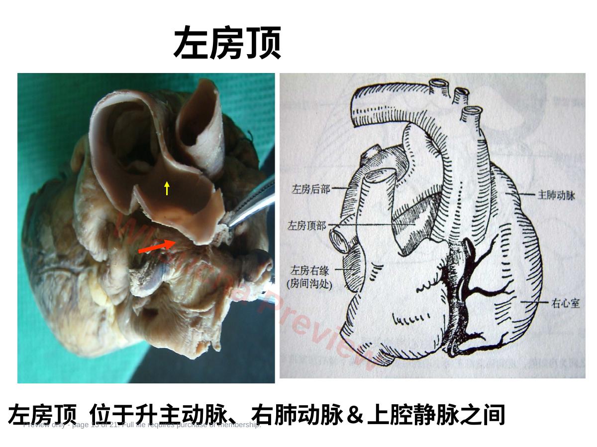 预览第 13 页