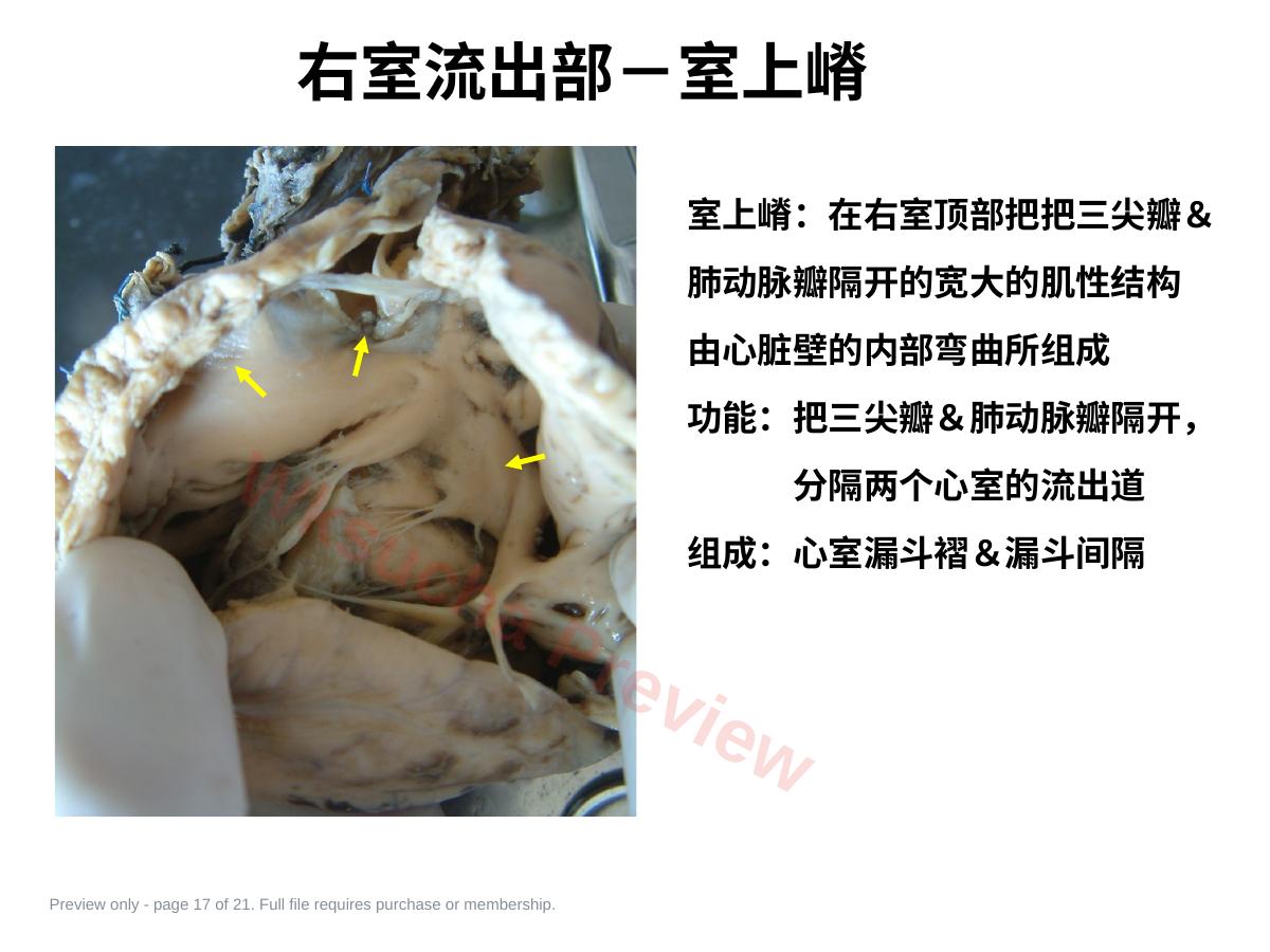 预览第 17 页