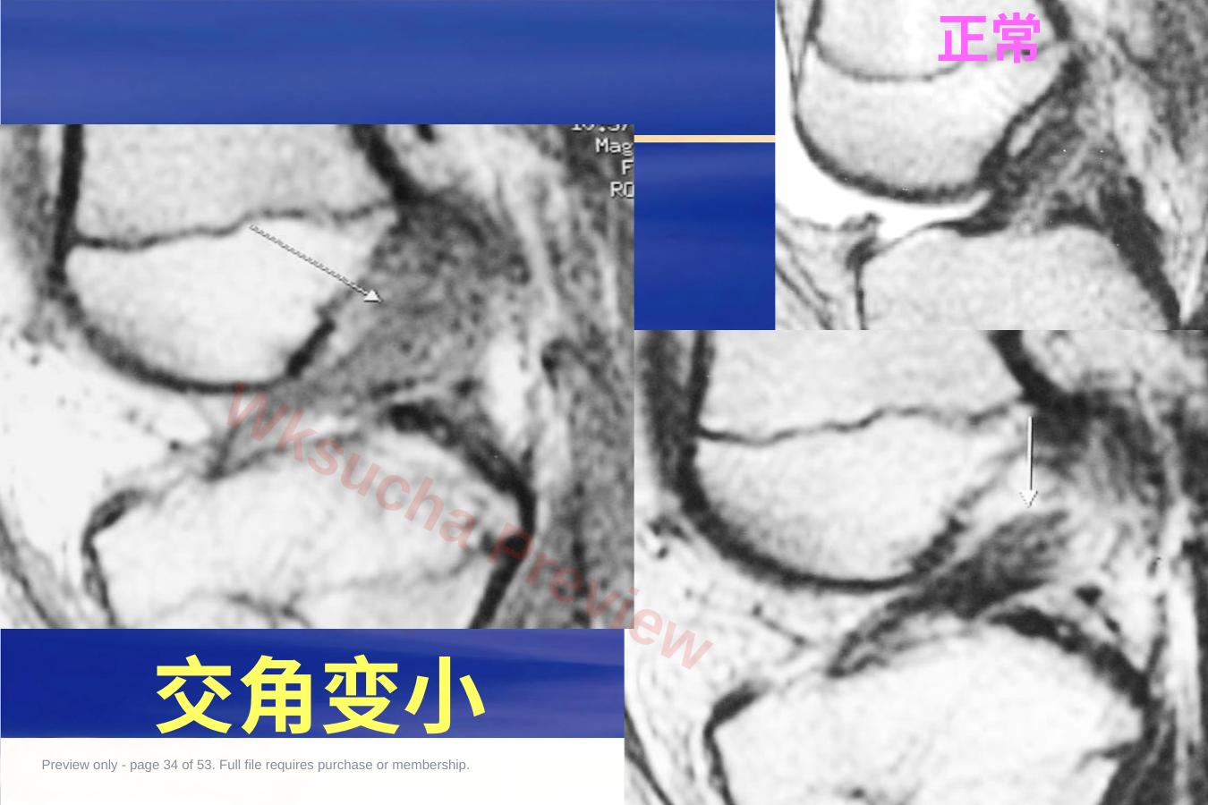 预览第 34 页
