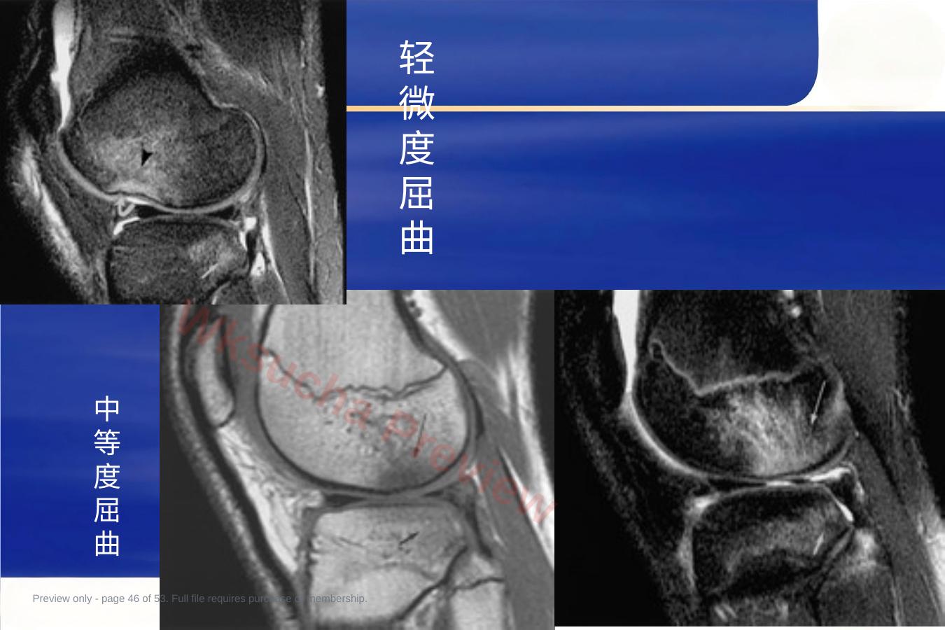 预览第 46 页