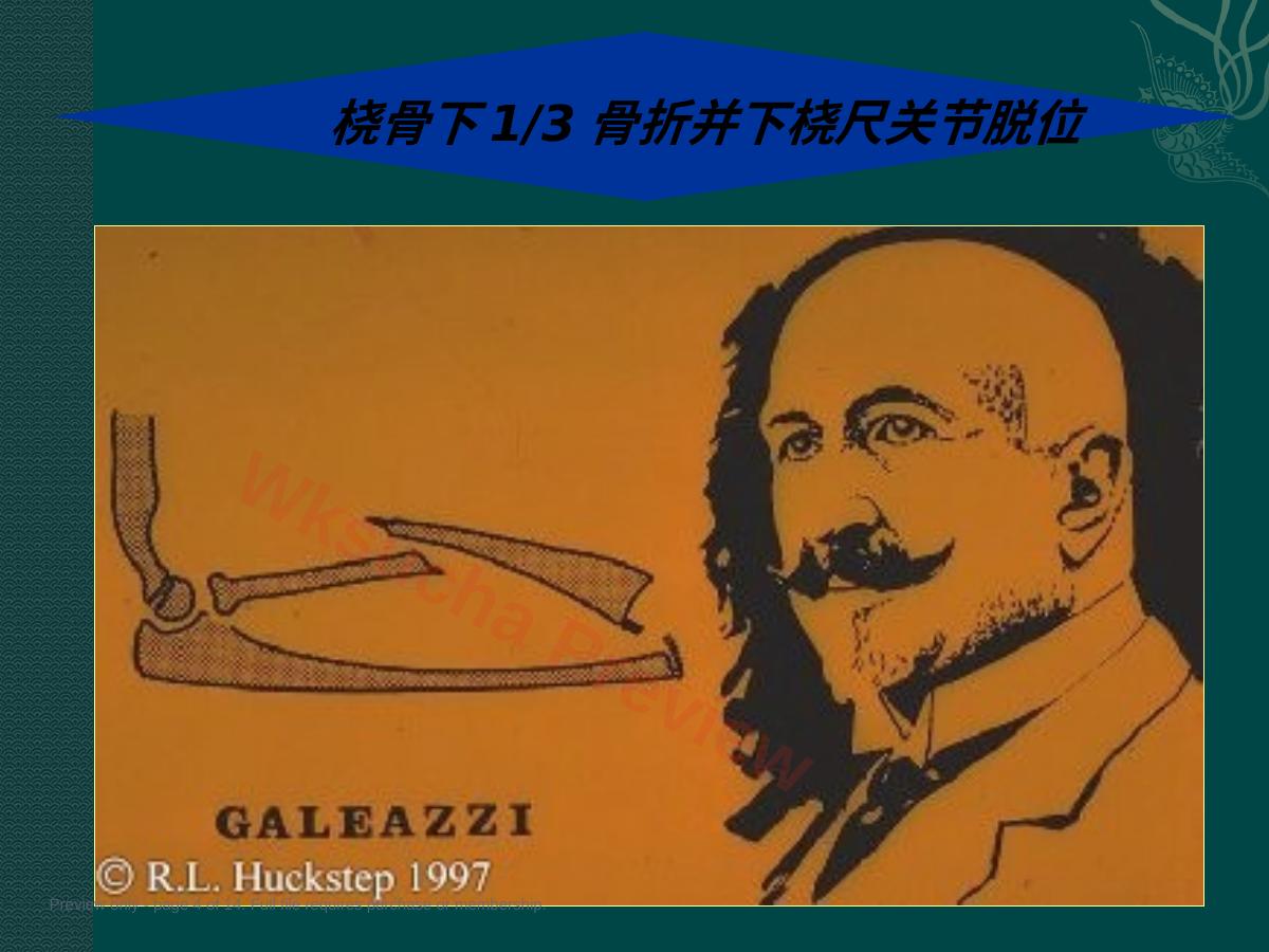 预览第 4 页