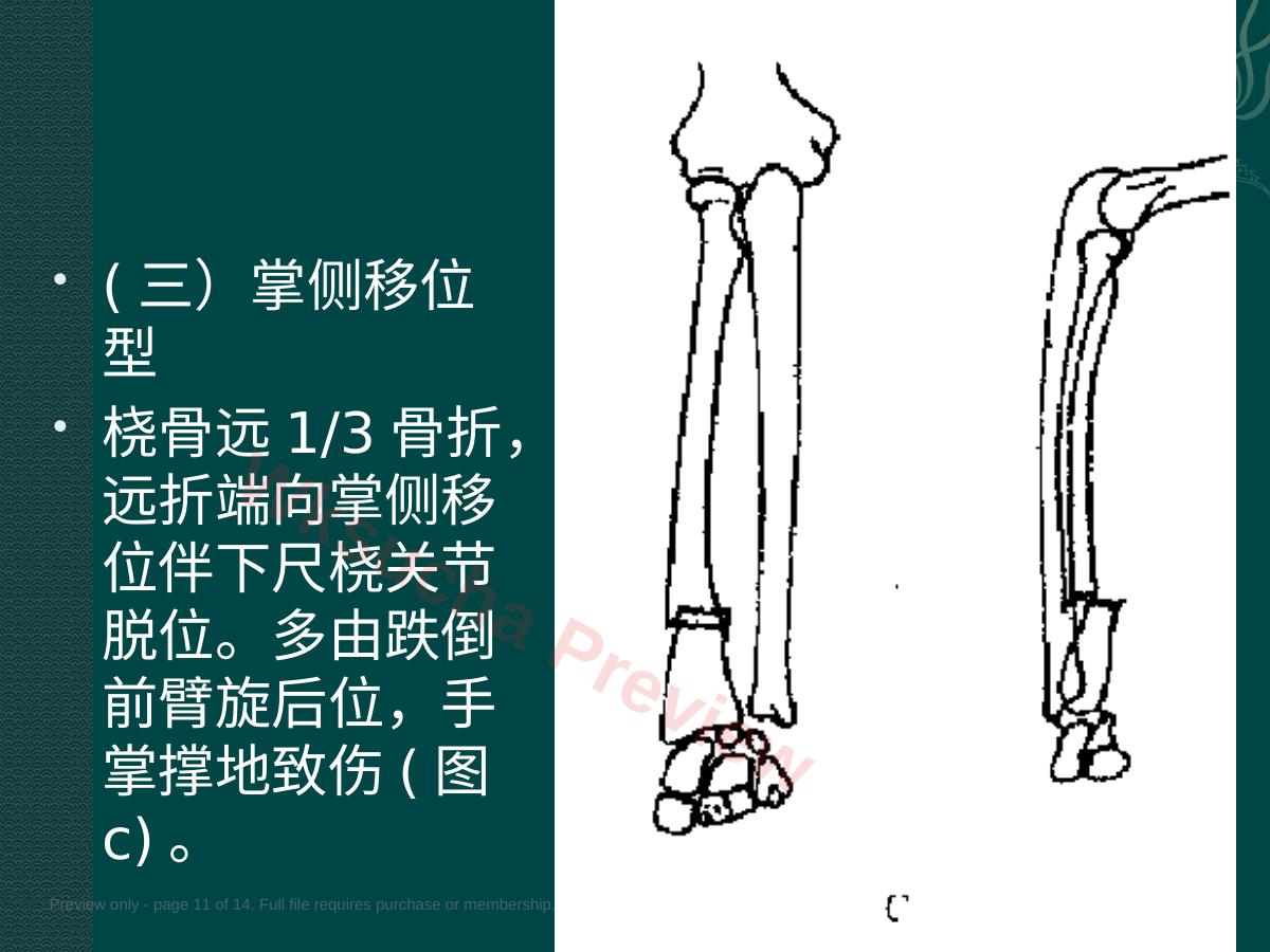 预览第 11 页