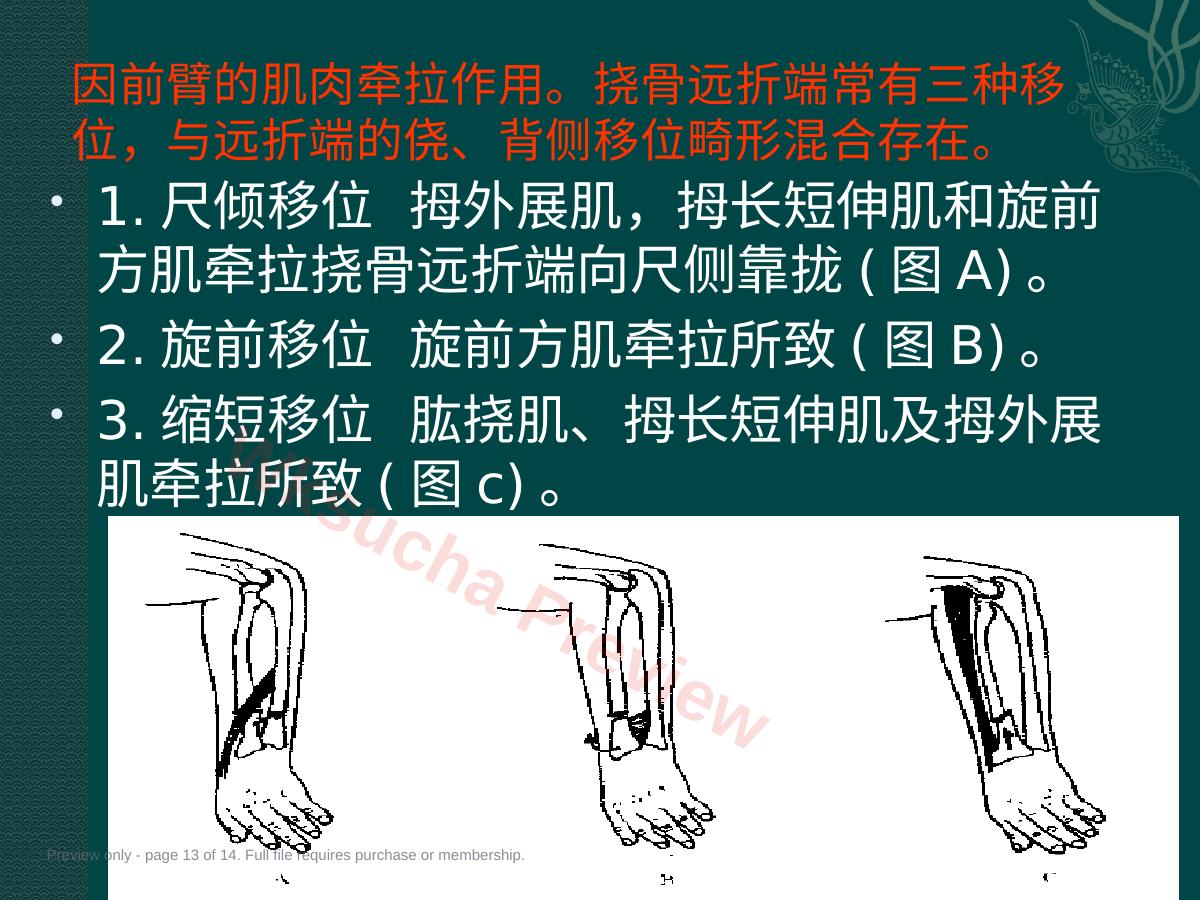 预览第 13 页